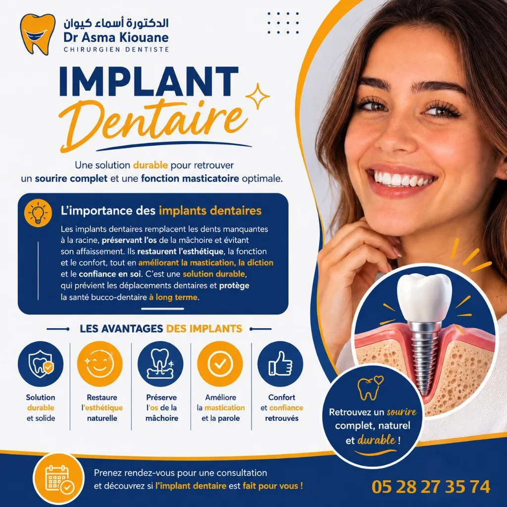 Implant Dentaire - Dr. Asma Kiouane